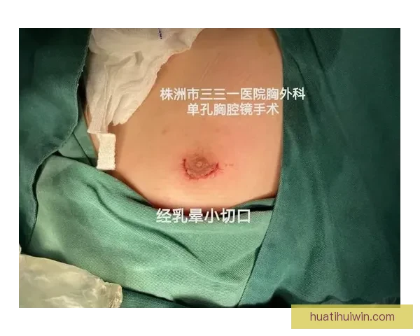 坎宁安气胸康复持续推进 活塞计划一周后复查评估